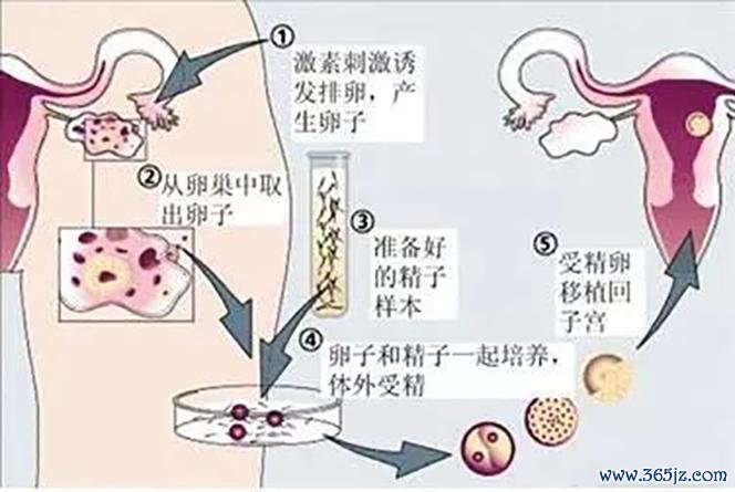 供卵助孕服务流程详解,助孕专家解答疑惑 供卵助孕服务流程详解,助孕专家解答疑惑